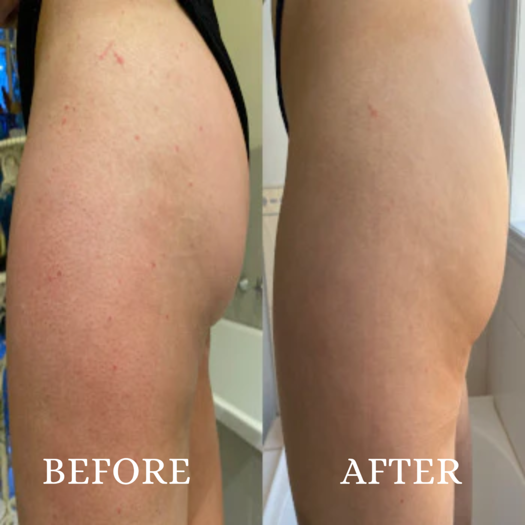why use Soap Sheep's exfoliating glove (2)